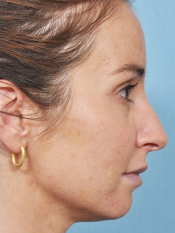 Case # 1 after photo