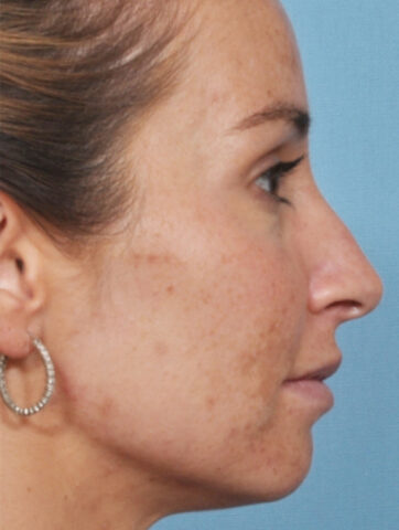 Case # 1 before photo