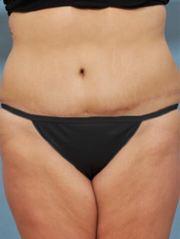 Case # 3 after photo