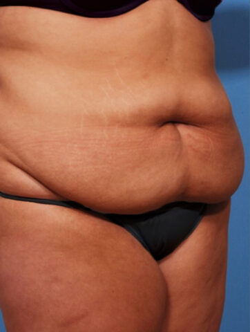 Case # 3 before photo