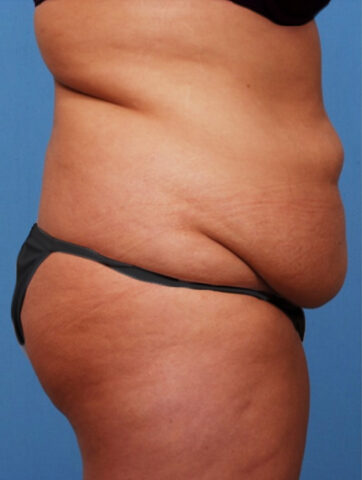 Case # 3 before photo