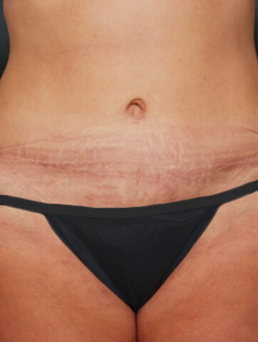 Case # 5 after photo