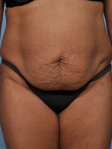 Case # 4 before photo