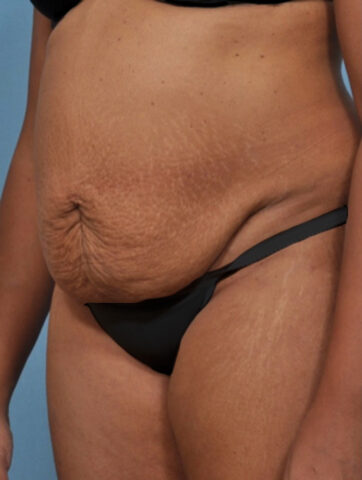 Case # 4 before photo