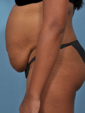 Case # 4 before photo