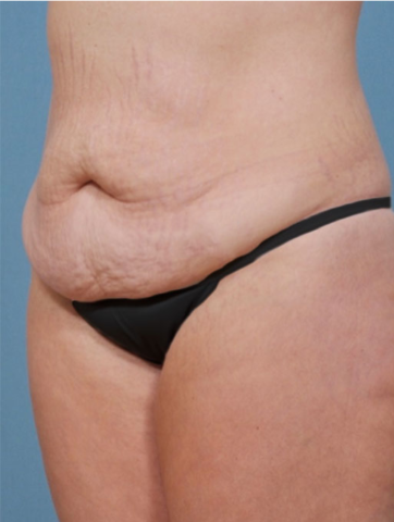 Case # 2 before photo