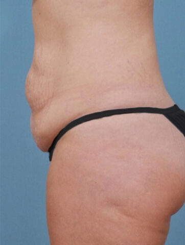 Case # 2 before photo