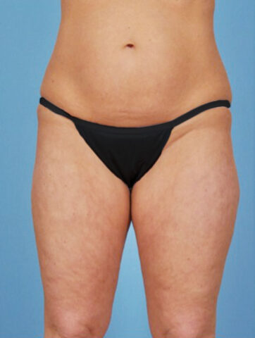 Case # 3 before photo