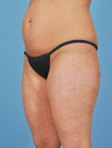 Case # 3 before photo