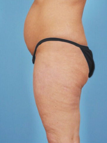 Case # 3 before photo