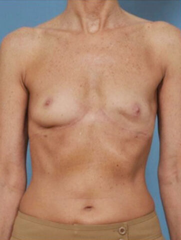 Case # 2 before photo