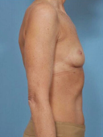 Case # 2 before photo