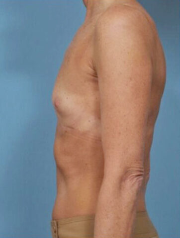 Case # 2 before photo