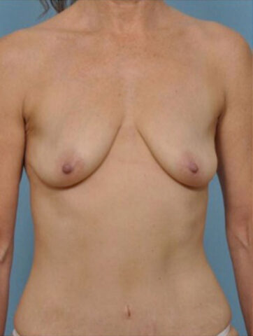 Case # 3 before photo