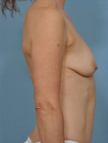 Case # 3 before photo