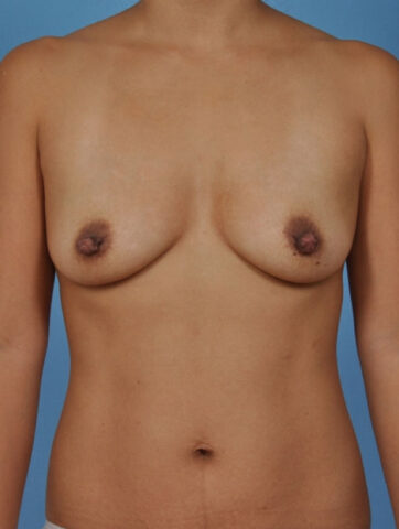 Case # 1 before photo