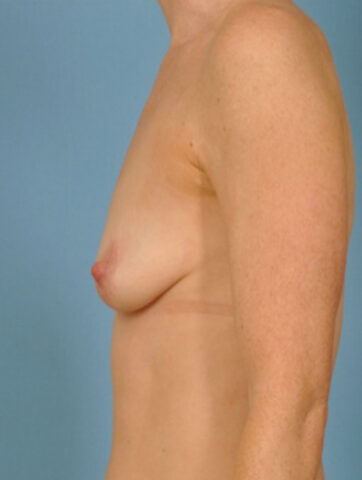 Case # 38 before photo