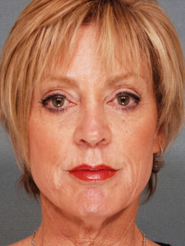 Case # 2 before photo