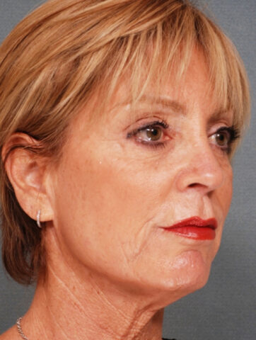 Case # 2 before photo