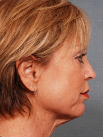 Case # 2 before photo