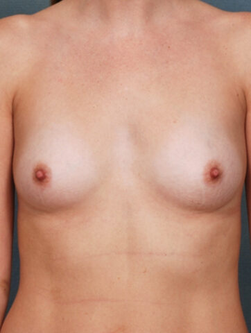 Case # 5 before photo