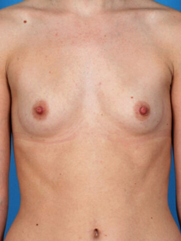 Case # 3 before photo