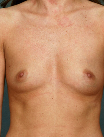 Case # 2 before photo