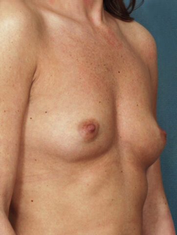 Case # 2 before photo