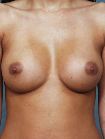 Case # 1 after photo