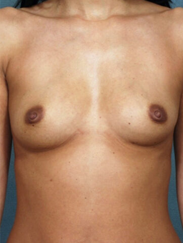 Case # 1 before photo