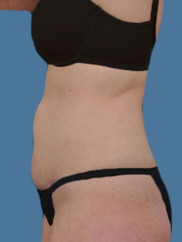 Case # 4 before photo