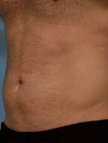 Case # 6 after photo