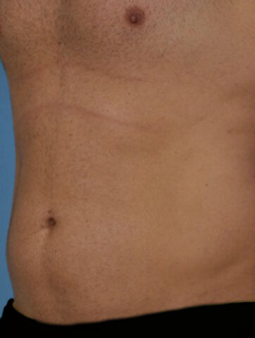 Case # 6 before photo