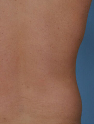 Case # 6 before photo