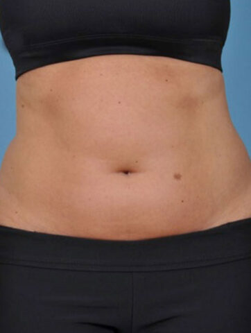 Case # 3 before photo