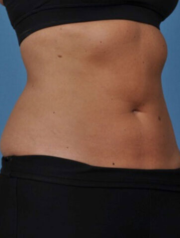 Case # 3 after photo