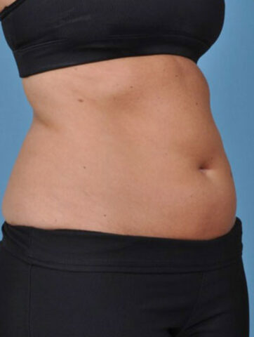 Case # 3 before photo