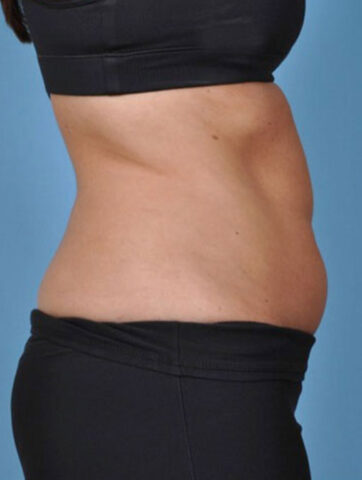 Case # 3 before photo