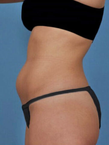 Case # 1 before photo