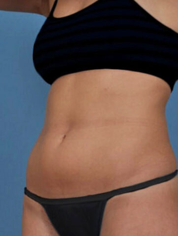 Case # 1 before photo