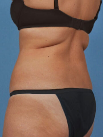 Case # 2 before photo