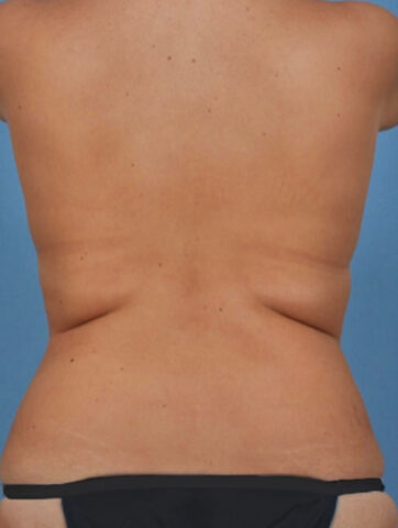 Case # 2 before photo