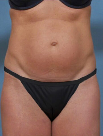 Case # 1 before photo