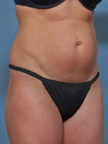 Case # 1 before photo