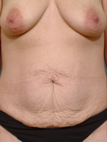 Case # 3 before photo