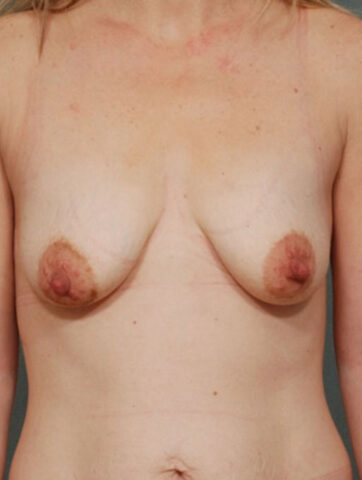 Case # 8 before photo