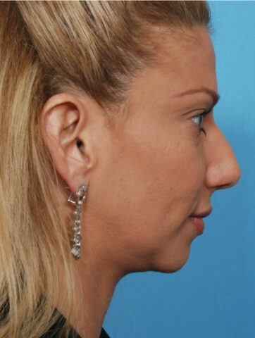 Case # 6 before photo