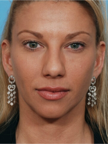 Case # 6 before photo