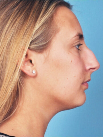 Case # 3 before photo