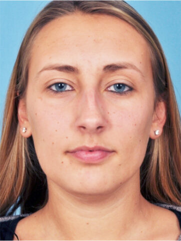 Case # 3 before photo